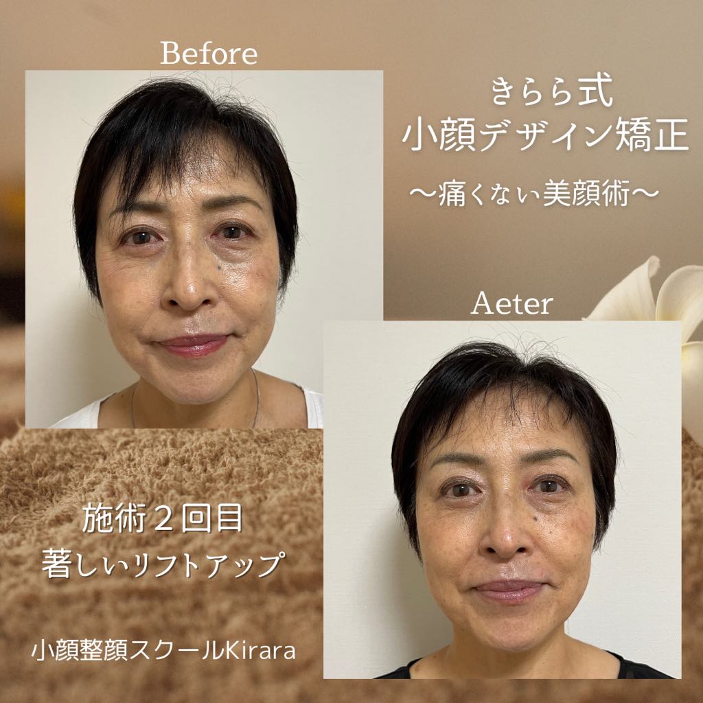 きらら式＊小顔デザイン矯正講座